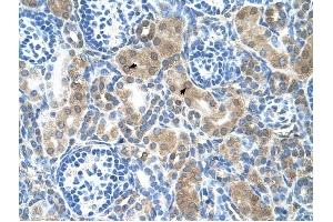 CBS antibody was used for immunohistochemistry at a concentration of 4-8 ug/ml to stain Epithelial cells of renal tubule (arrows) in Human Kidney. (CBS Antikörper  (N-Term))
