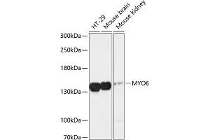 Western blot analysis of extracts of various cell lines, using MYO6 antibody (ABIN6129617, ABIN6144291, ABIN6144292 and ABIN6216869) at 1:3000 dilution. (Myosin VI Antikörper  (AA 1016-1285))