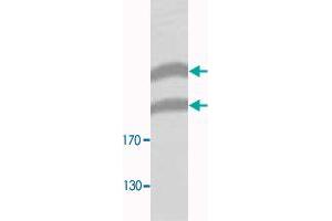 Western blot analysis of HeLa membrane fraction lysate with PLXNB1 polyclonal antibody  at 1 : 300 dilution. (PLXNB1 Antikörper  (N-Term))