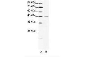 Image no. 1 for anti-Cholinergic Receptor, Nicotinic, delta (Muscle) (CHRND) (N-Term) antibody (ABIN202701)