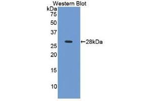 WB of Protein Standard: different control antibodies against Highly purified E. (TNNI3 CLIA Kit)