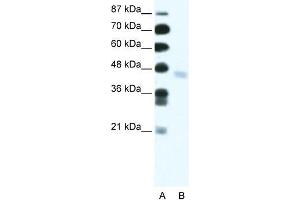 Human Jurkat; WB Suggested Anti-ZNF312 Antibody Titration: 2. (FEZF2 Antikörper  (N-Term))