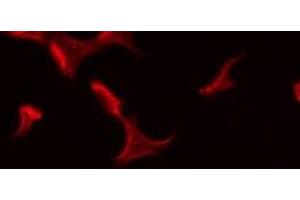 Immunofluorescence (fixed cells) (IF/ICC) image for anti-ATPase, Na+/K+ Transporting, beta 3 Polypeptide (ATP1B3) (Internal Region) antibody (ABIN6256917)