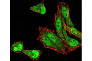 Immunofluorescence analysis of Hela cells using MGMT mouse mAb (green).