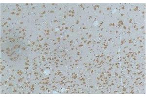 Immunohistochemistry of paraffin-embedded Rat brain tissue using Phospho-CAMK2 beta/gamma/delta (Thr287) Monoclonal Antibody at dilution of 1:200. (CaMK2 beta/gamma/delta (pThr287) Antikörper)