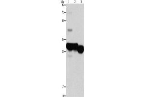 Western Blotting (WB) image for anti-Ketohexokinase (KHK) antibody (ABIN2422886) (Ketohexokinase Antikörper)