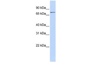 WB Suggested Anti-NCAPH2 Antibody Titration: 0. (NCAPH2 Antikörper  (N-Term))