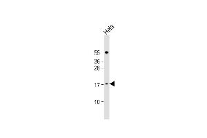 LSM7 Antikörper  (C-Term)