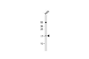 Anti-LSM7 Antibody (C-term) at 1:1000 dilution + Hela whole cell lysate Lysates/proteins at 20 μg per lane. (LSM7 Antikörper  (C-Term))