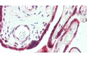 Immunohistochemistry of paraffin-embedded Human Placenta using PAPPA Polyclonal Antibody at dilution of 1:100. (PAPPA Antikörper)