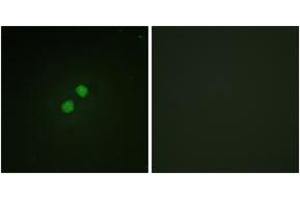 Immunofluorescence analysis of NIH-3T3 cells, using Nibrin (Phospho-Ser278) Antibody. (Nibrin Antikörper  (pSer278))