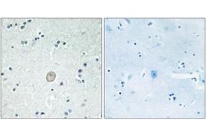 Immunohistochemistry analysis of paraffin-embedded human brain tissue, using C3AR1 Antibody.
