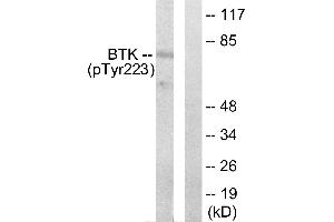 Western blot analysis of extracts from Hela cells treated with serum (10%, 15mins), using BTK (phospho-Tyr223) antibody. (BTK Antikörper  (pTyr223))