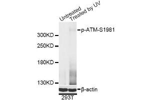 Western blot analysis of extracts of 293T cells, using Phospho-ATM-S1981 antibody (ABIN5969871) at 1/2000 dilution.