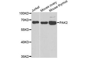 Western blot analysis of extracts of various cell lines, using PAK2 antibody. (PAK2 Antikörper  (AA 1-212))