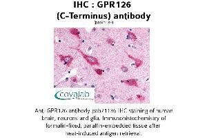 Image no. 1 for anti-G Protein-Coupled Receptor 126 (GPR126) (C-Term) antibody (ABIN1734923) (G Protein-Coupled Receptor 126 Antikörper  (C-Term))