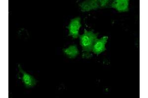 Anti-KHK mouse monoclonal antibody (ABIN2453197) immunofluorescent staining of COS7 cells transiently transfected by pCMV6-ENTRY KHK (RC202424). (Ketohexokinase Antikörper)