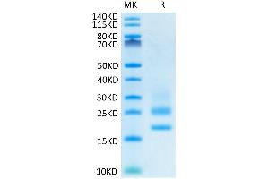 CD83 Protein (CD83) (AA 20-143) (His tag)