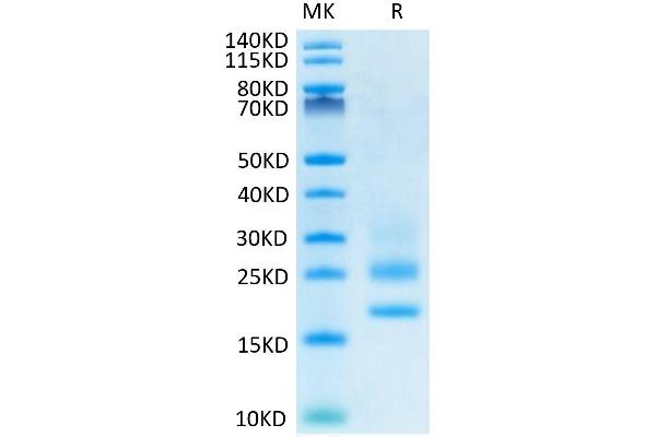 CD83 Protein (CD83) (AA 20-143) (His tag)