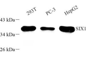 Western blot analysis of SIX1 (ABIN7075617) at dilution of 1: 500 (SIX Homeobox 1 Antikörper)