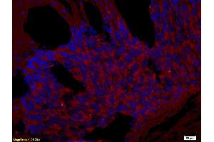 Formalin-fixed and paraffin embedded rat brain tissue labeled with Rabbit Anti-CD272/BTLA Polyclonal Antibody (ABIN671031), Unconjugated at 1:200 followed by conjugation to the secondary antibody and DAB staining. (BTLA Antikörper  (AA 221-289))