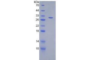 SDS-PAGE analysis of Mouse DGKa Protein. (DGKA Protein)