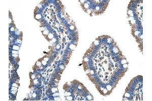 FUS antibody was used for immunohistochemistry at a concentration of 4-8 ug/ml to stain Epithelial cells of intestinal villus (arrows) in Human Intestine. (FUS Antikörper  (N-Term))