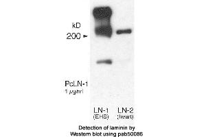 Image no. 1 for anti-Laminin (LN) antibody (ABIN363395) (Laminin Antikörper)