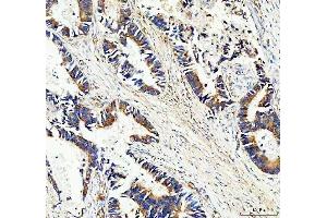IHC analysis of MASPIN/SERPINB5 using anti-MASPIN/SERPINB5 antibody (ABIN3043330).