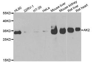 Western blot analysis of extracts of various cell lines, using AK2 antibody. (Adenylate Kinase 2 Antikörper)