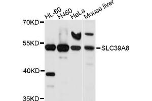Western blot analysis of extracts of various cell lines, using SLC39A8 antibody (ABIN5998862) at 1/1000 dilution. (SLC39A8 Antikörper)