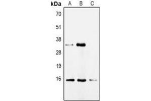 Western blot analysis of CDA expression in HepG2 (A), Hela (B), mouse kidney (C) whole cell lysates. (CDA Antikörper)