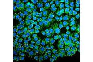 IF analysis of NDUFB10 using anti-NDUFB10 antibody (ABIN7601461).