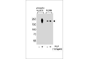 Western blot analysis of lysate from A431 cells(from left to right),untreated or treated with EGF at 100 ng/mL,using Phospho-EGFR-p Antibody (ABIN389891 and ABIN2839735) or EGFR-p Antibody. (EGFR Antikörper  (pTyr1016))