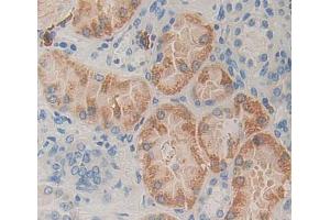 Used in DAB staining on fromalin fixed paraffin- embedded kidney tissue (MCCC2 Antikörper  (AA 337-563))
