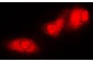 Immunofluorescent analysis of S6K1 staining in MCF7 cells. (RPS6KB1 Antikörper  (C-Term))