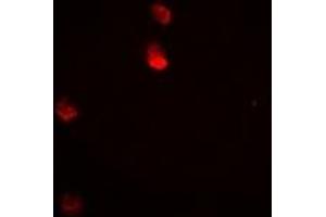 Immunofluorescent analysis of JNK1 staining in Hela cells. (JNK Antikörper)