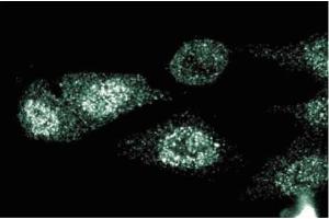 Immunofluorescent staining of HeLa cells. (CD40 Antikörper  (AA 71-187))