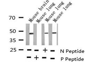 Western blot analysis of Phospho-E2F1 (Thr433) expression in various lysates (E2F1 Antikörper  (pThr433))