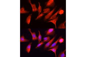 Immunofluorescence (IF) image for anti-Eukaryotic Translation Initiation Factor 2 alpha Kinase 4 (EIF2AK4) (AA 1-300) antibody (ABIN6140031)