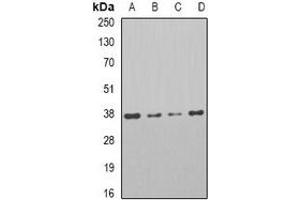 Western blot analysis of PAR6A expression in HT29 (A), Jrukat (B), Raji (C), mouse testis (D) whole cell lysates. (PARD6A Antikörper)