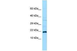 Host:  Rabbit  Target Name:  Grem1  Sample Type:  Mouse Testis lysates  Antibody Dilution:  1. (GREM1 Antikörper  (C-Term))