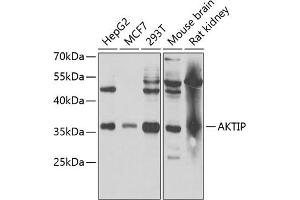 Western blot analysis of extracts of various cell lines, using AKTIP antibody (ABIN6131091, ABIN6136746, ABIN6136748 and ABIN6221837) at 1:1000 dilution. (AKTIP Antikörper  (AA 1-292))