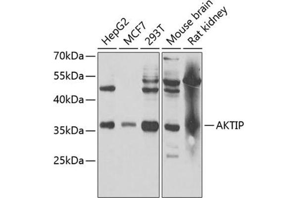 AKTIP 抗体  (AA 1-292)