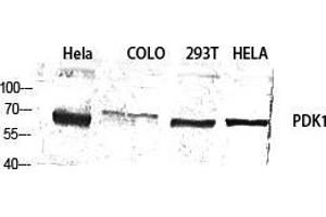 Western Blot (WB) analysis of specific cells using PDK1 Polyclonal Antibody. (PDPK1 Antikörper  (Thr222))