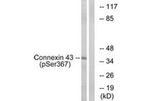 Western blot analysis of extracts from K562 cells treated with PMA 200ng/ml 10', using Connexin 43 (Phospho-Ser367) Antibody. (Connexin 43/GJA1 Antikörper  (pSer367))