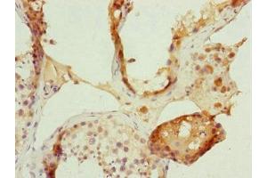 Immunohistochemistry of paraffin-embedded human testis tissue using ABIN7152485 at dilution of 1:100 (FBXL5 Antikörper  (AA 1-310))