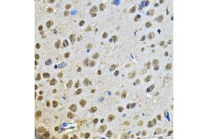 Immunohistochemistry of paraffin-embedded rat brain using PPID Antibody. (PPID Antikörper  (AA 161-370))