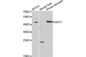 Western blot analysis of extracts of various cell lines, using GGT1 antibody. (GGT1 Antikörper  (AA 370-569))