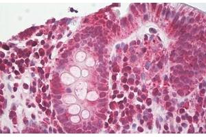 Image no. 2 for anti-NLR Family, Pyrin Domain Containing 3 (NLRP3) (AA 158-207) antibody (ABIN6749780) (NLRP3 Antikörper  (AA 158-207))